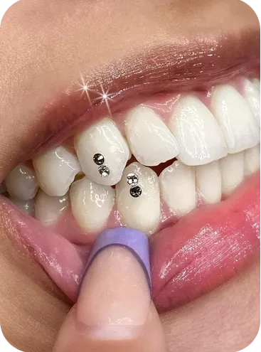 boca